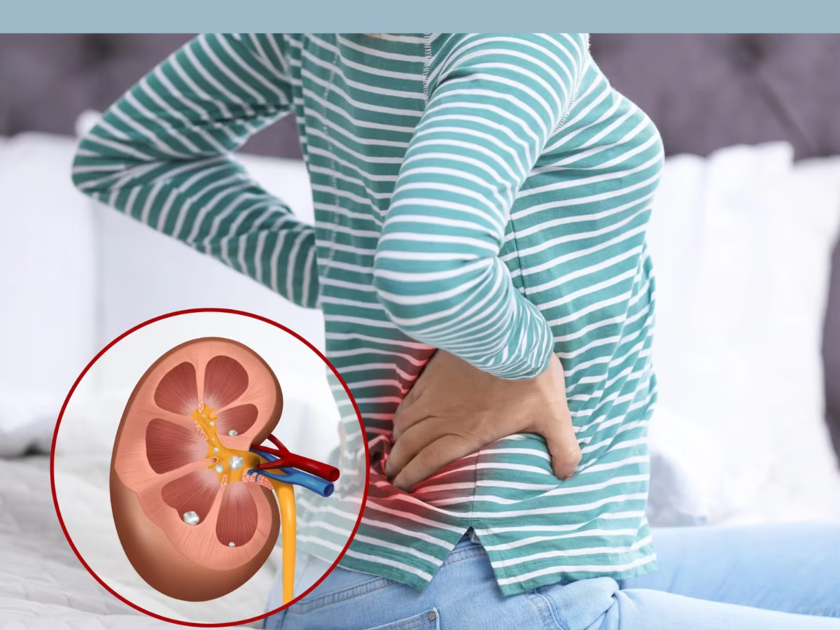 Kidney Stone च्या रुग्णांनी चुकूनही खाऊ नका 6 फळं; जीवावर बेतेल